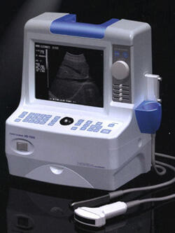 Портативный УЗИ сканер HS-1500