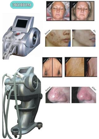 Косметологический аппарат IPL+RF SB-041