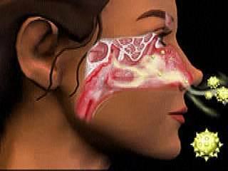 Зачем нужна очистка вентиляции? Зачем нужна очистка вентиляции?