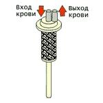 Насадка перфузионная щелевой фильтр