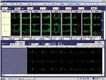 Rozinn Electronics, Holter for Windows1